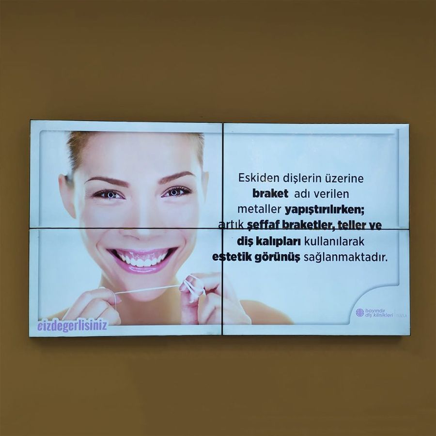 Özel Diş Kliniği Bekleme Salonu Videowall Projesi