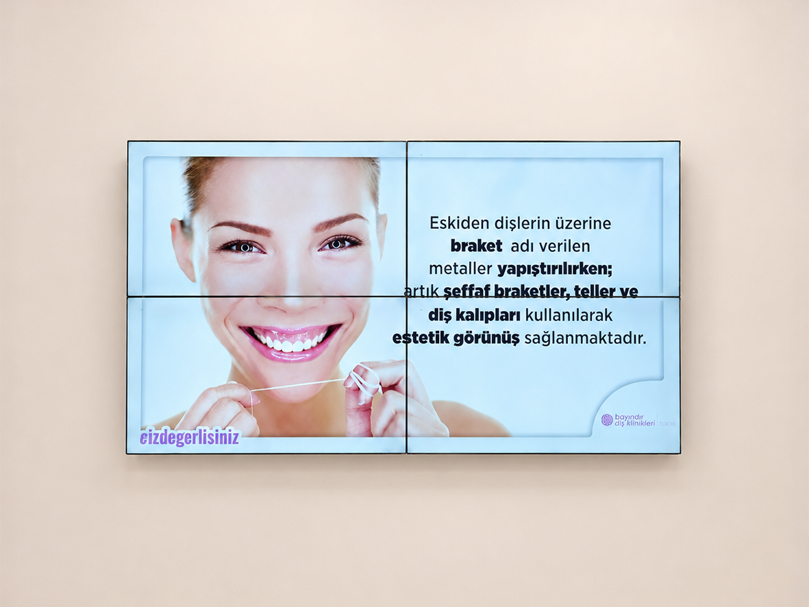 Bayındır Diş Kliniği Videowall Projesi